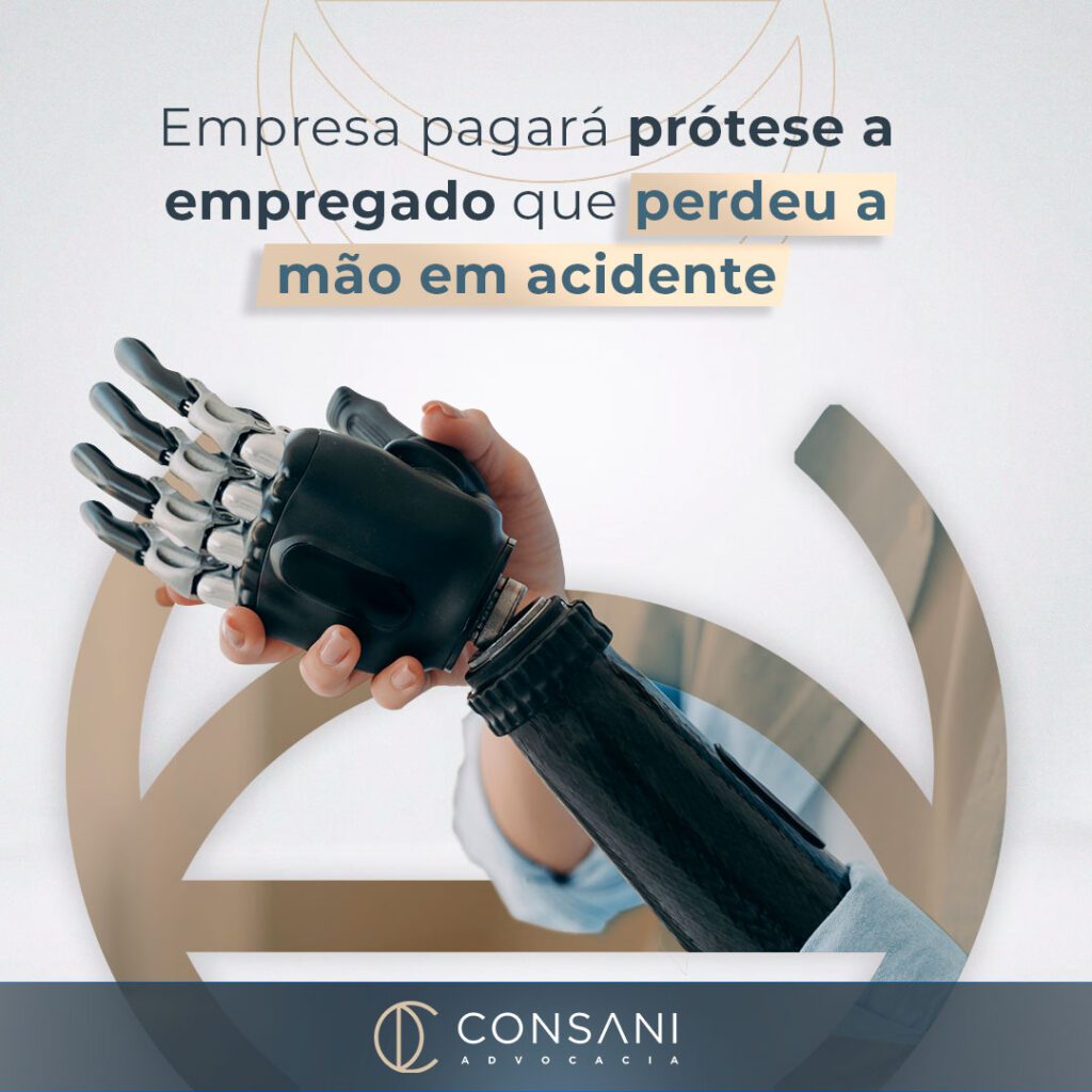 Empresa pagará prótese a empregado que perdeu a mão em acidente